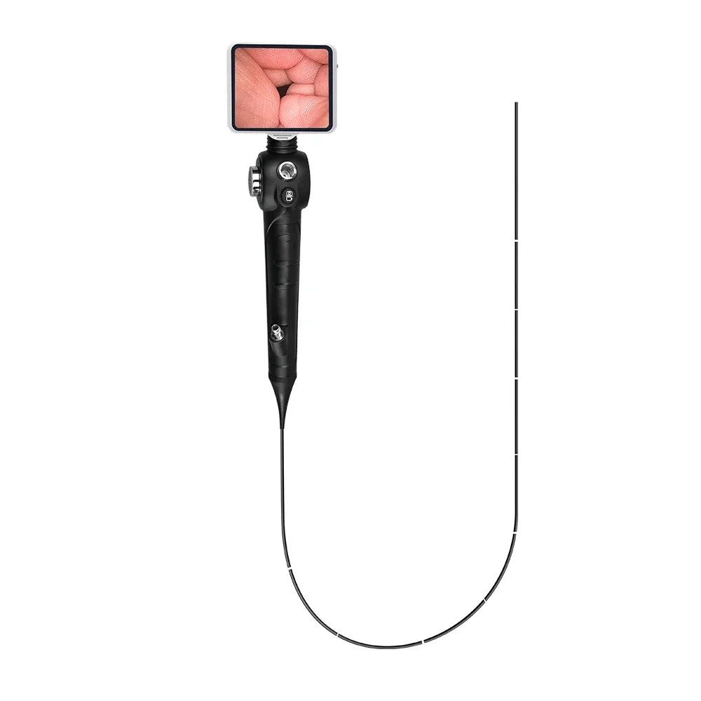 Laryngoscope ENT Endoscopy System กล้องเอนโดสโคปพร้อมกล้องเอนโดสโคปแบบยืดหยุ่น