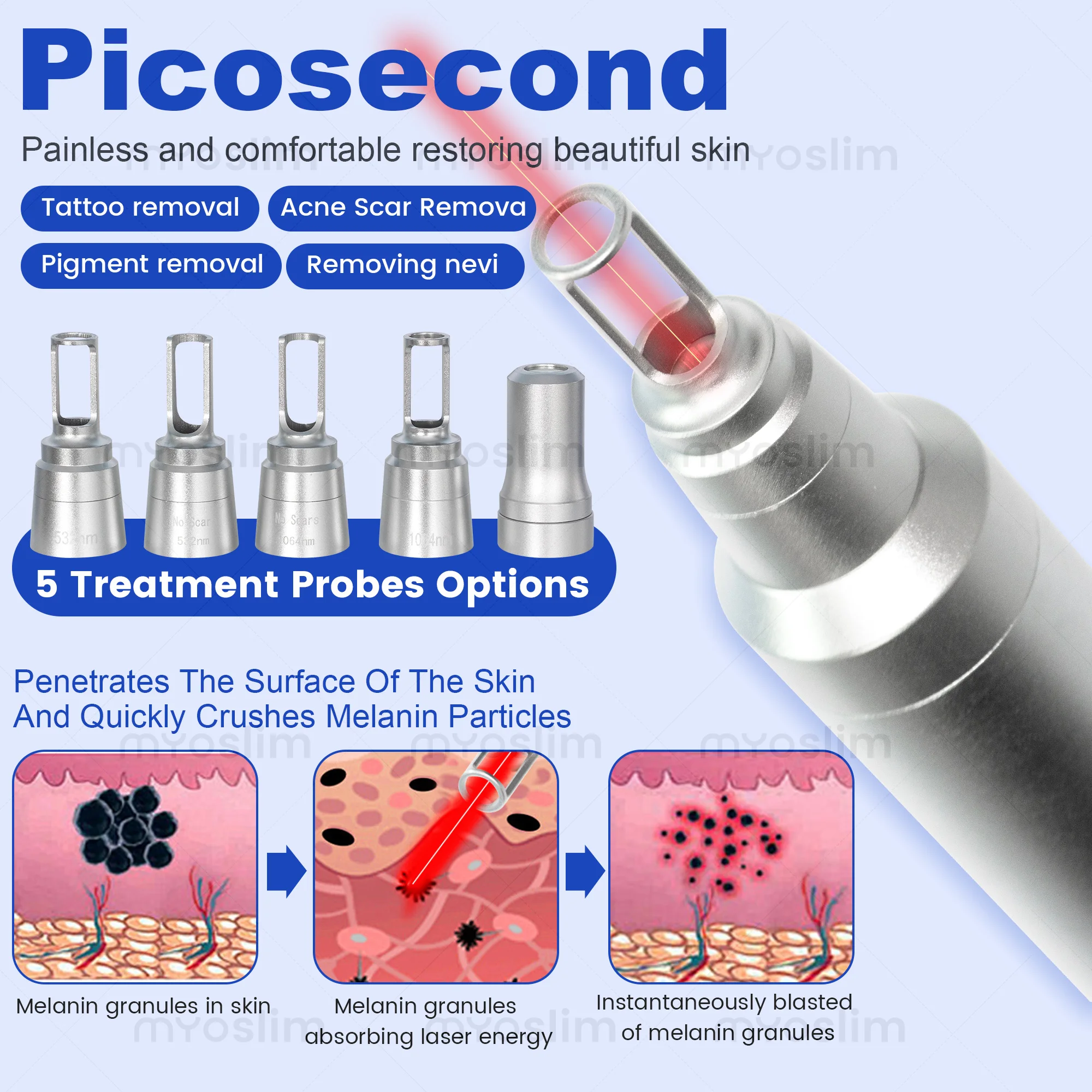 5000W Picosecond Diode Penghil - Industrial Laser Hair Removal Machine ulasan dan harga