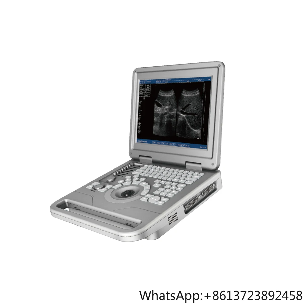 

Vet Black and White Ultrasound Scanner Hospital Equipment Veterinary Cardiac Ultrasound Machine