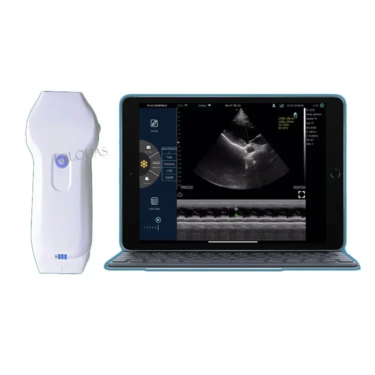 LHA10XL Medical  Ultrasound Instruments Color Doppler Wireless Usb Heart Ultrasound Probe