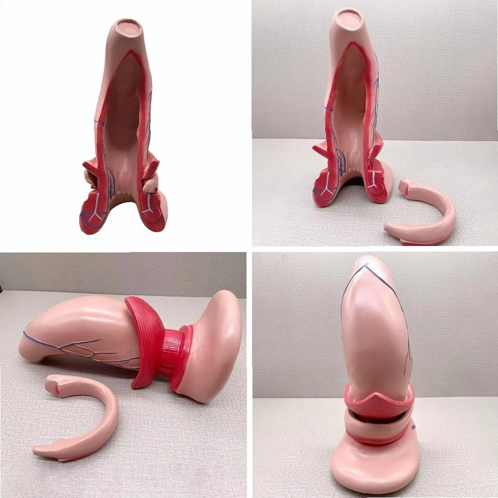 Anatomical Model of Rectum, Anus, Anal Ring and Venous Plexus for Medical Teaching