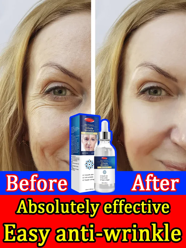 

Restore beautiful appearance and remove wrinkles