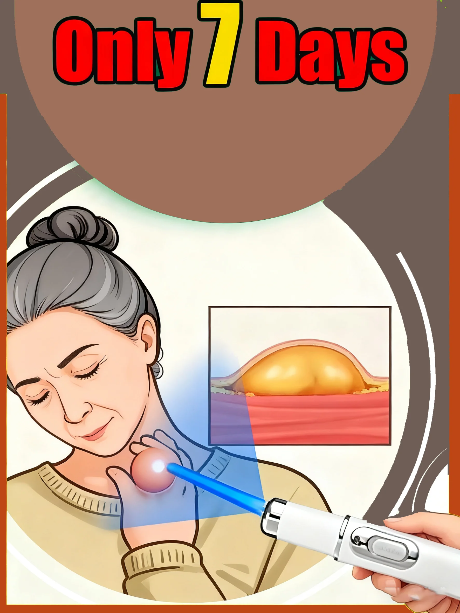 

Набор многофункциональных лазерных ручек Blue Light для дома 2025 года, эксперт по здравоохранению кожи, длительное управление вашей кожей