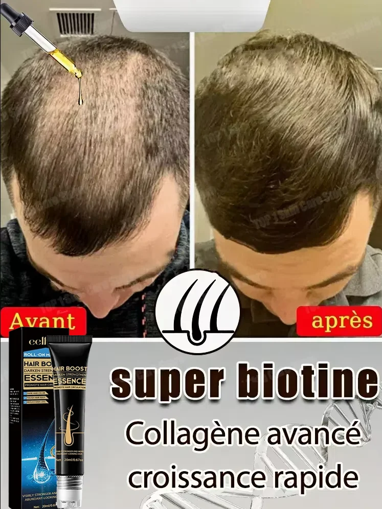 

Nourishing hair and improving postpartum hair loss and alopecia areata