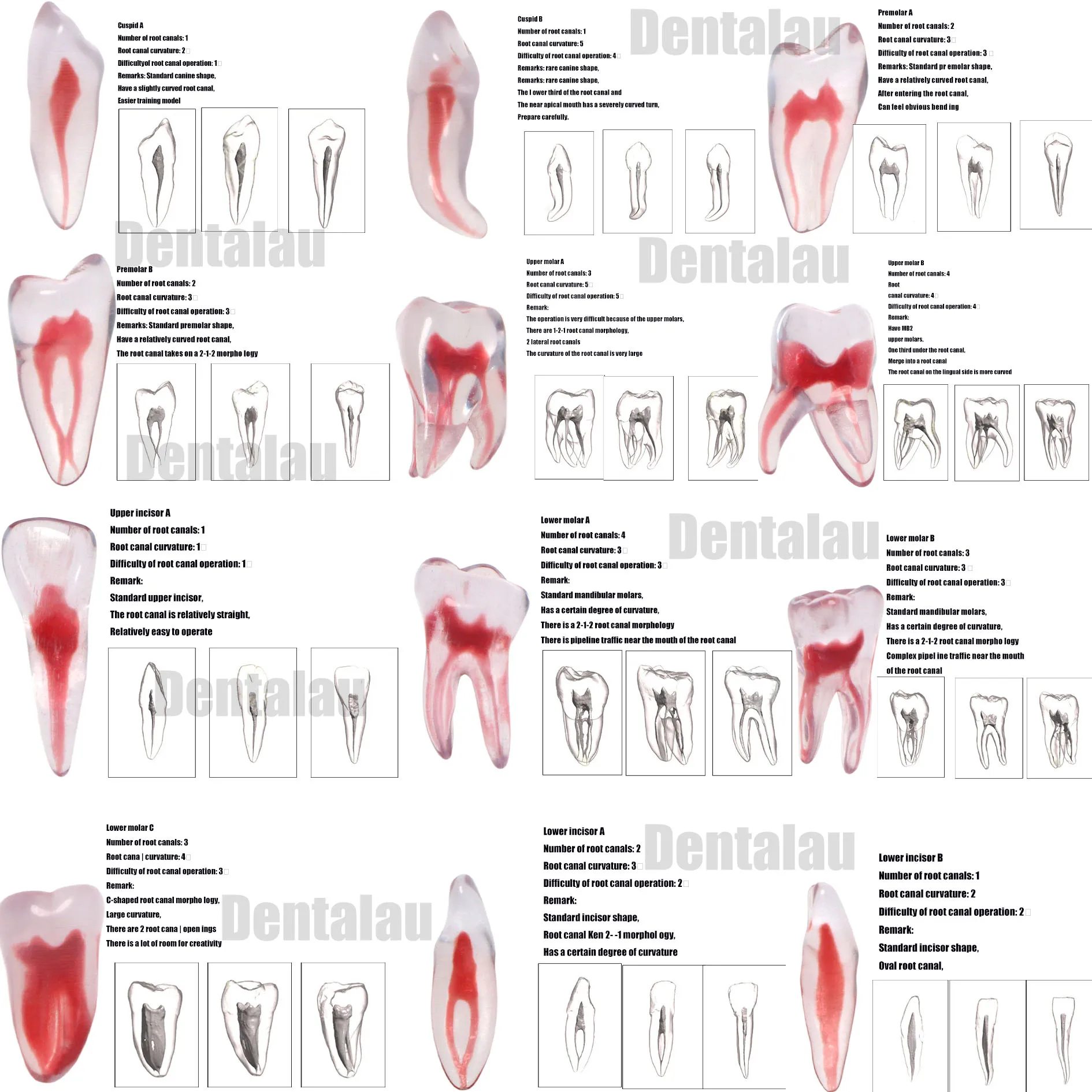 

12 Size Dental RCT Endo Training Teeth Model 3D Curved Root Resin Endodontic Education Cavity