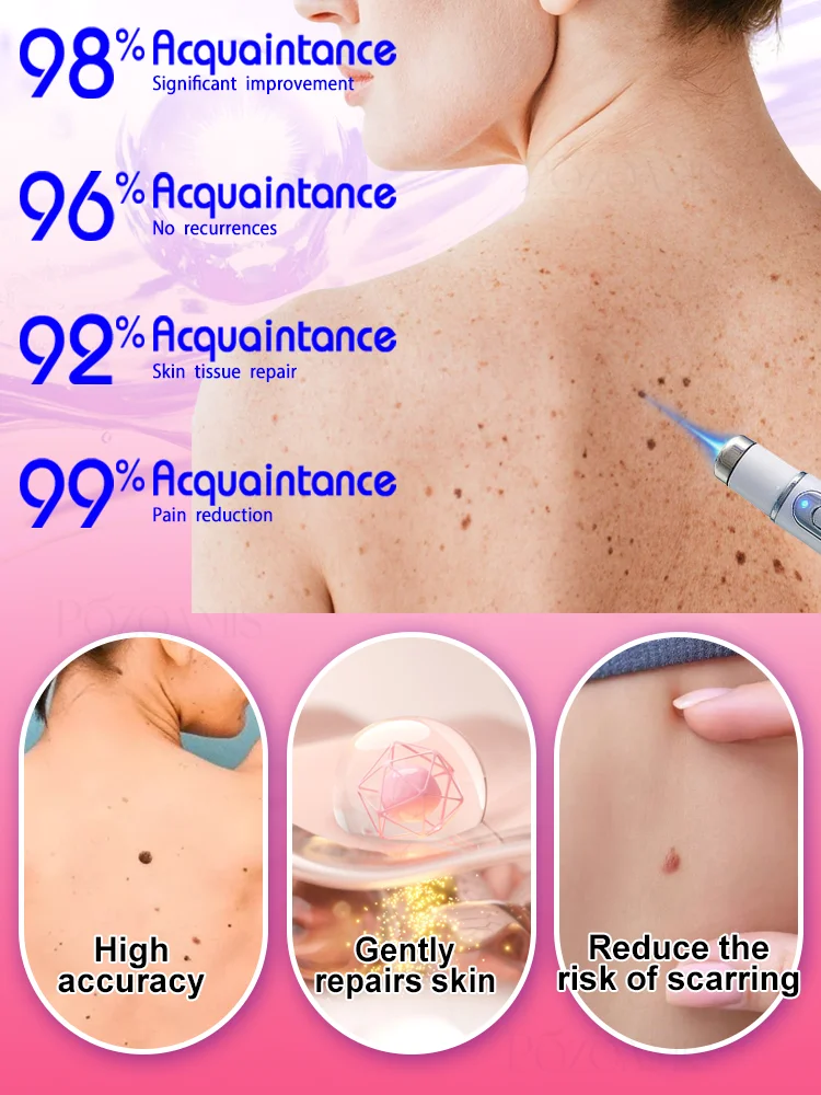 ʙʟᴜᴇ ʟɪɢʜᴛ ᴘᴇɴ sᴏʟᴠᴇ ᴡᴀʀᴛs, ʜᴏᴛ sᴀʟᴇ ᴡᴀʀᴛ ᴄᴀʀᴇ ᴛᴏᴏʟs