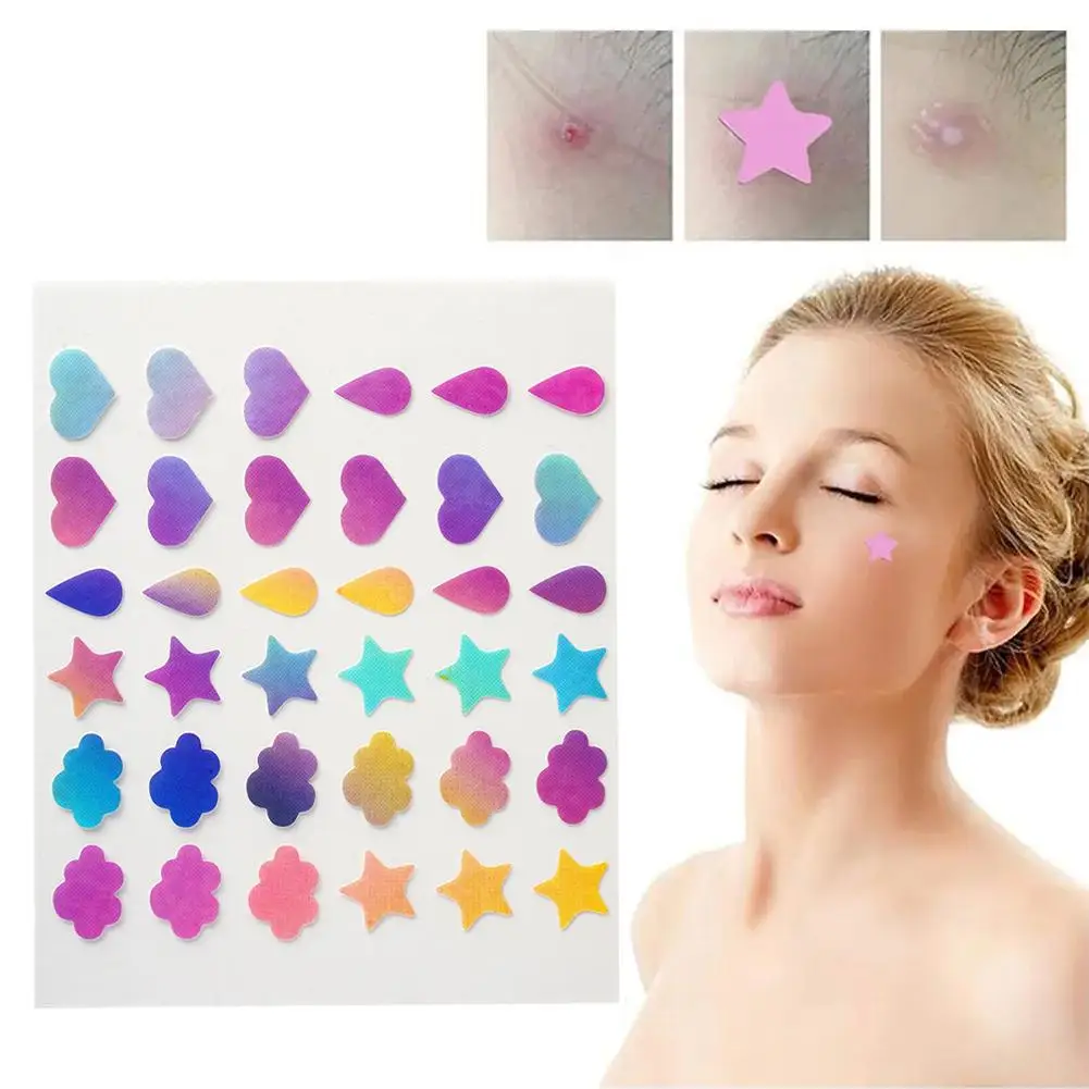 36pcs Colorful Laser Invisible Acne Removal Pimple Patch Beauty Acne Pimple Acne Concealer Face Spot Scar Care Sticker