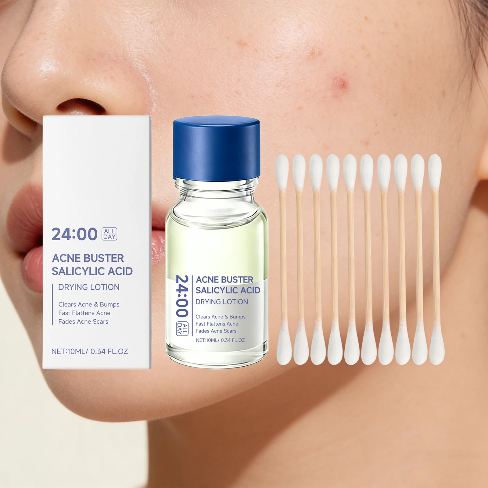 Salicylic Acid Acne Drying Lotion Pimple Remover Serum Fade Marks Shrink Pores Oil Control Face Care with Swabs - view 6
