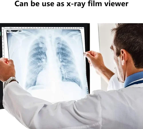 Imagen 2 del producto Tableta de dibujo A4/A3/A2, tableta gráfica Digital wacom, tablero de luz LED con pintura de diamante, tablero portátil para visor de películas de rayos X