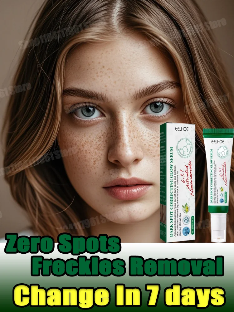 

Whitening Freckle Cream Niacinamide Remove Dark Spot Cream Anti Freckle and Aging Cream Fade Pigmentation Melasma Skin Care
