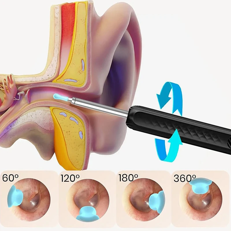 Ear Cleaner with Camera Wireless WiFi Ear Pick Otoscope USB C Charging Endoscope Ear Wax Removal Tool Earpick Ear Cleaning Set