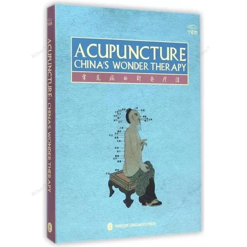 Acupuncture China's Wonder Therapy Chinese Medicine Acupuncture Book in English