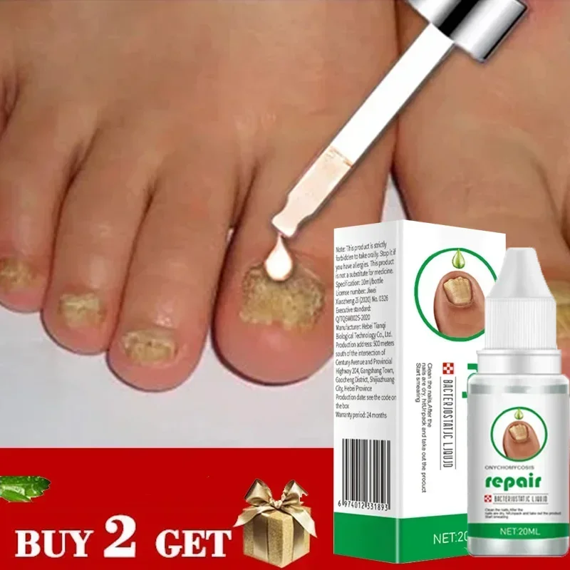 Nail Fungus Treatment Serum Toe Fungal Repair Products Hand Foot Care Removal Gel Anti Infection Onychomycosis Paronychia