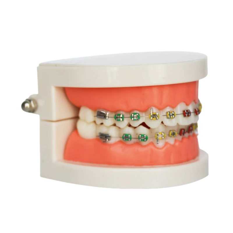 Orthodontics Denture Model with Colorful Braces Denture Mouth Model Display Teaching Model for Dentistry Dental Study Supplies