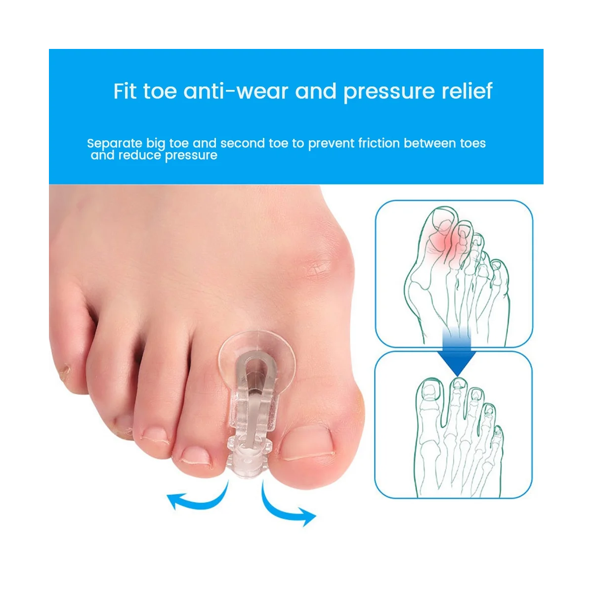 2 Stuks Teen Separator Voeten Zorg Beschermer Siliconen Teen Orthopedische Benodigdheden Bunion Corrector Hallux Valgus Voor Pedicure