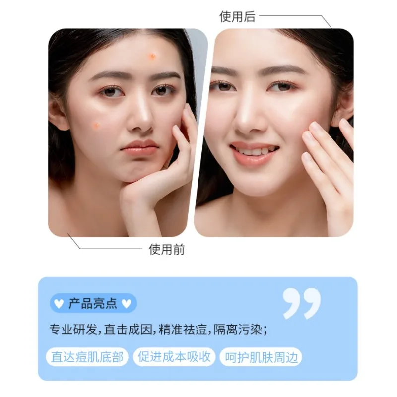 แผ่นแปะรักษาสิวแบบคอลลอยด์ แผ่นแปะซ่อมแซมรอยแผลเป็นจากสิว ลดเลือนและซ่อมแซมรอยแผลเป็นจากสิว แผ่นแปะกำจัดสิว อุปกรณ์ดูแลผิวหน้า