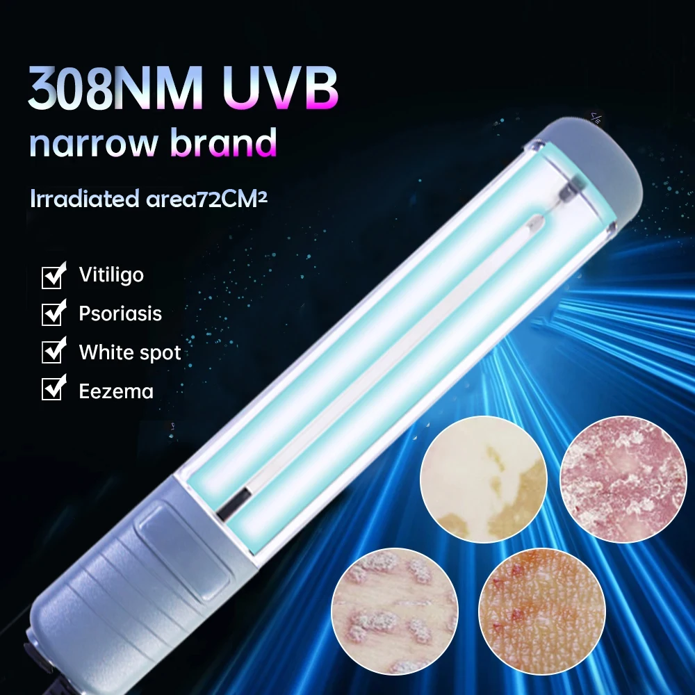 

UVB Lamp for Therapy Vitiligo Psoriasis Skin Treatment Light 308nm Narrowband Ultraviolet uv Phototherapy Instrument