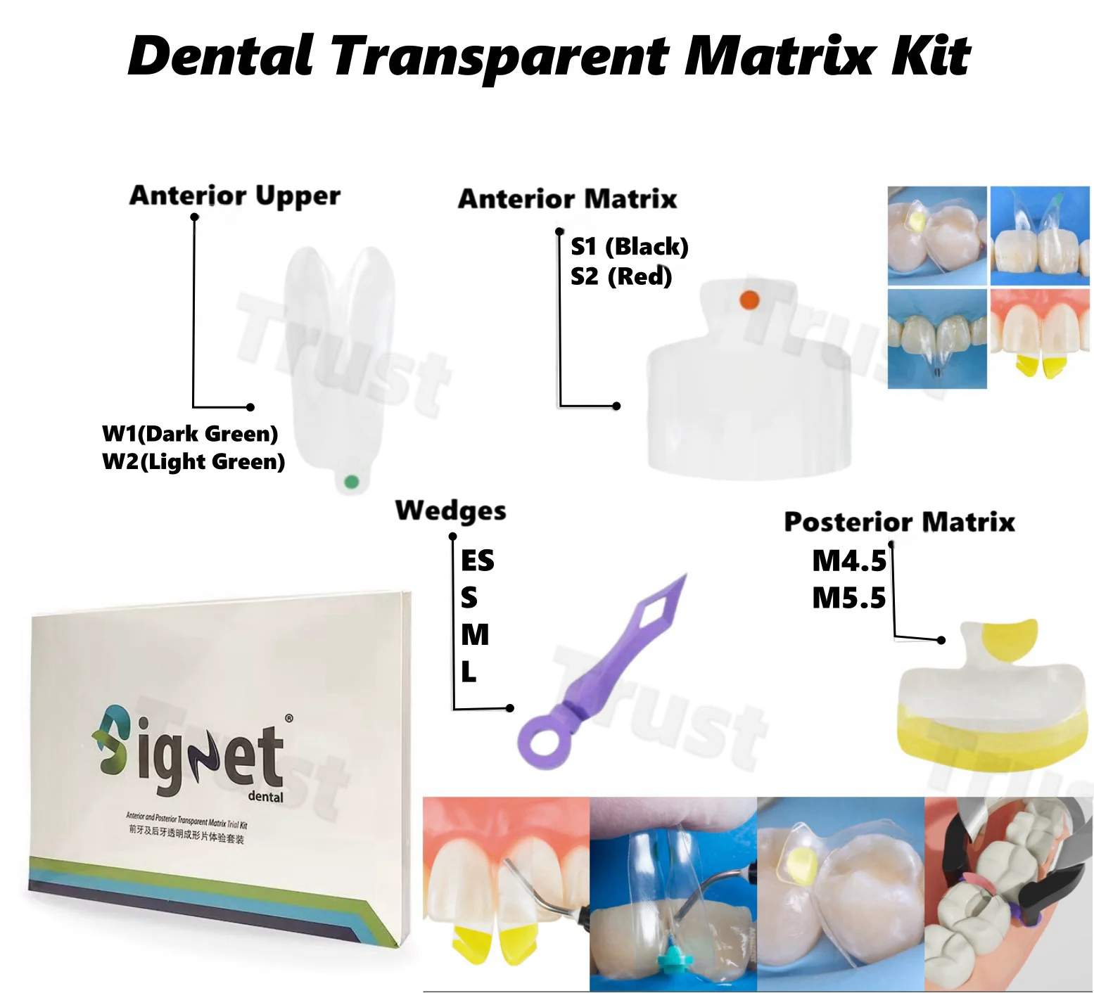 

150 Pcs/Box Dental Clear Matrix Diastema Matrices Wedges Similar with BioClear Matrice