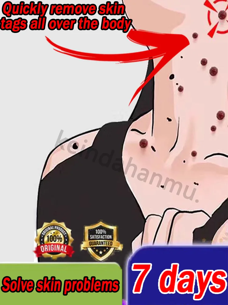 

ᔆᴋɪɴ ᴍᴀɴᴀɢᴇᴍᴇɴᴛ ᴍᴀᴋᴇˢ ʏᴏᴜ ʟɪᴠᴇ ᴡɪᴛʜ ᴄᴏɴғɪᴅᴇɴᴄᴇ Get rid of troubles