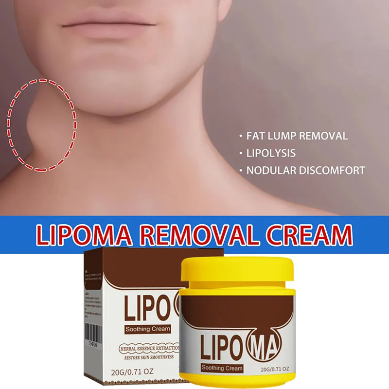 Subcutaneous Lumps Remove Soothing Cream Skin Swelling Cellulite Fibroma Fat Mass Plaster Treatment Medicine Liquid Products