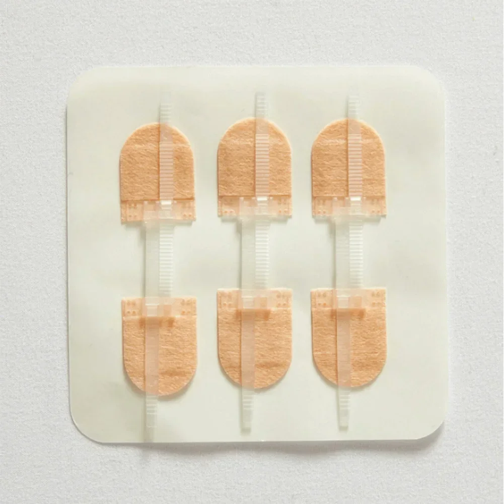 3 قطعة/المجموعة الفرقة المعونة سستة التعادل الجرح إغلاق التصحيح مرقئ التصحيح الجرح خياطة سريعة سستة الفرقة المعونة جهاز الطوارئ في الهواء الطلق