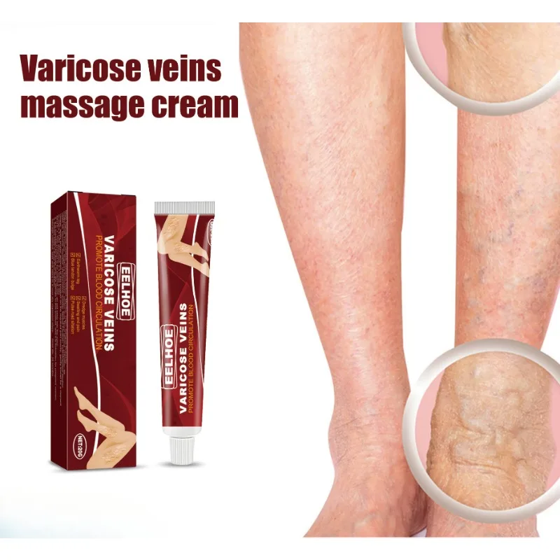 Venous Massage Varicose Veins Cream Relieve Swelling Pain Leg Vascular Protrusion Vasculitis Phlebitis Spider Leg Repair