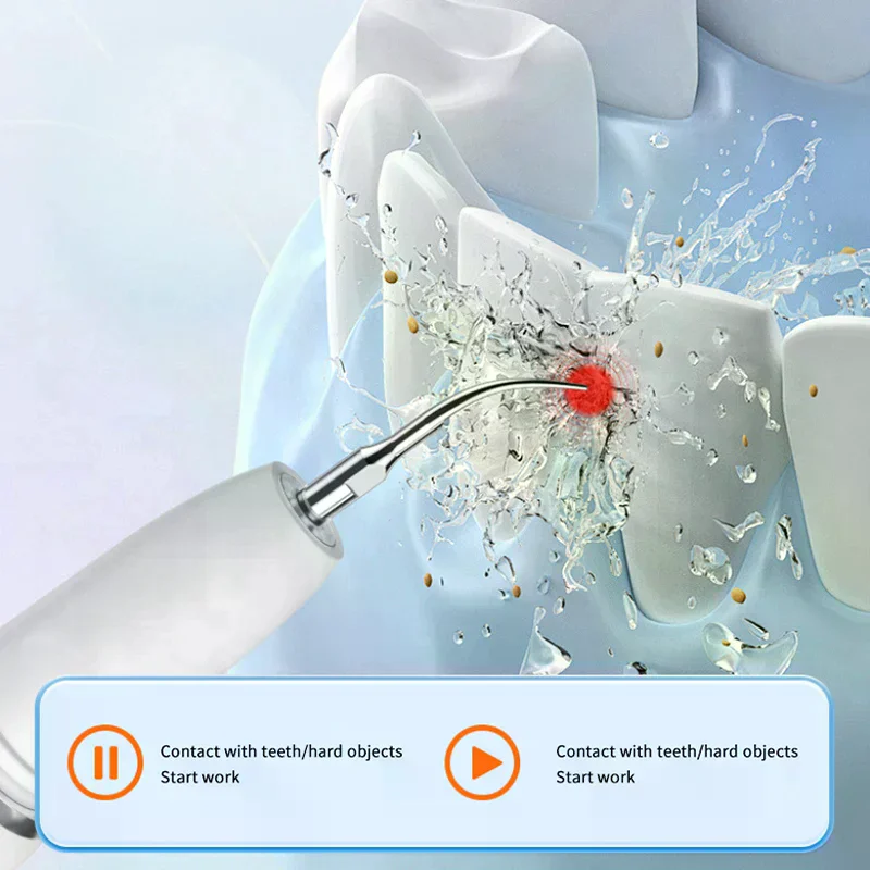 

Портативный ультразвуковой стоматологический скалер с пятью режимами, высокочастотный ирригатор для чистки полости рта, очиститель от зубного налета, средство для удаления зубного камня