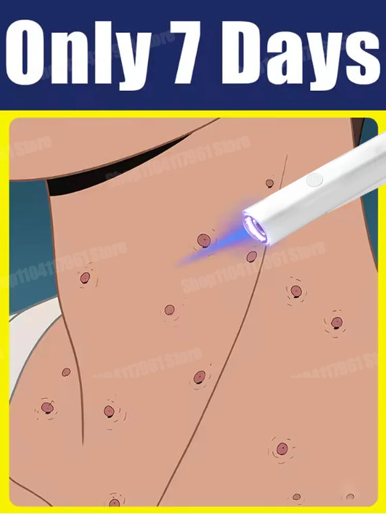 

2025 2nd ᵍᵉⁿᵉʳᵃᵗⁱᵒⁿ ᵘᵖᵍʳᵃᵈᵉᵈ wᵃʳᵗ ⸴ ᑫᵘⁱᶜᵏˡʸ， ʳᵉpᵃⁱʳ wᵃʳᵗˢ ʳᵒoᵗ