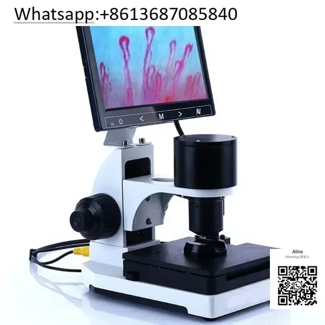 

Nail Fold Microcirculation Blood Capillary Microscope