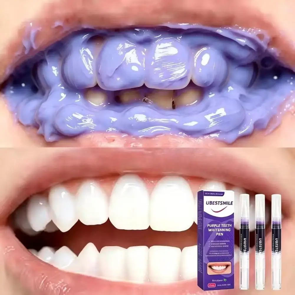 Purple Teeth Whitening Pen, No‑Sensitivity Formula, Remove Tartar & Tooth Stains for Brighter Whiter Smile Purple Instant Clean
