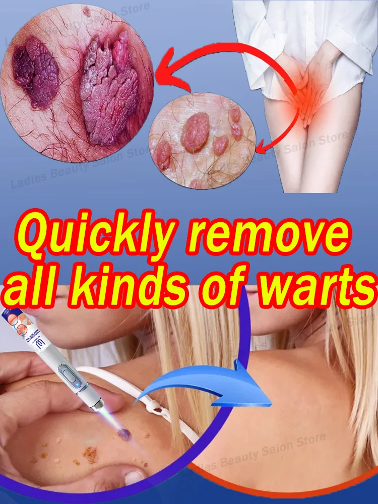 

Dᴇ́ʙᴀʀʀᴀssᴇᴢ-ᴠᴏᴜs ᴅᴇs ᴠᴇʀʀᴜᴇs ᴇᴛ ᴅɪᴛᴇs ᴀᴅɪᴇᴜ ᴀᴜx ᴘʀᴏʙʟᴇ̀ᴍᴇs ᴅᴇ ᴘᴇᴀᴜ