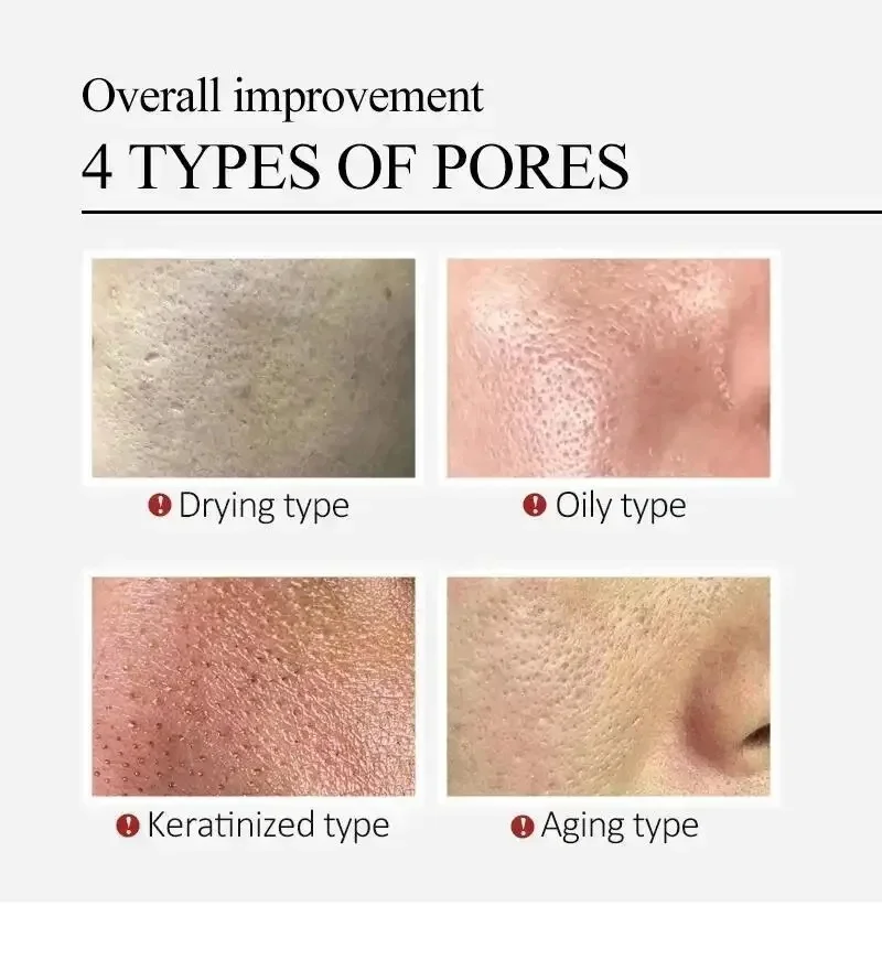 Centella Asiatica Shrink Pores Face Serum Fade Facial Redness Blood Cream  Moisturizing Brightening  Korea Skincare Product