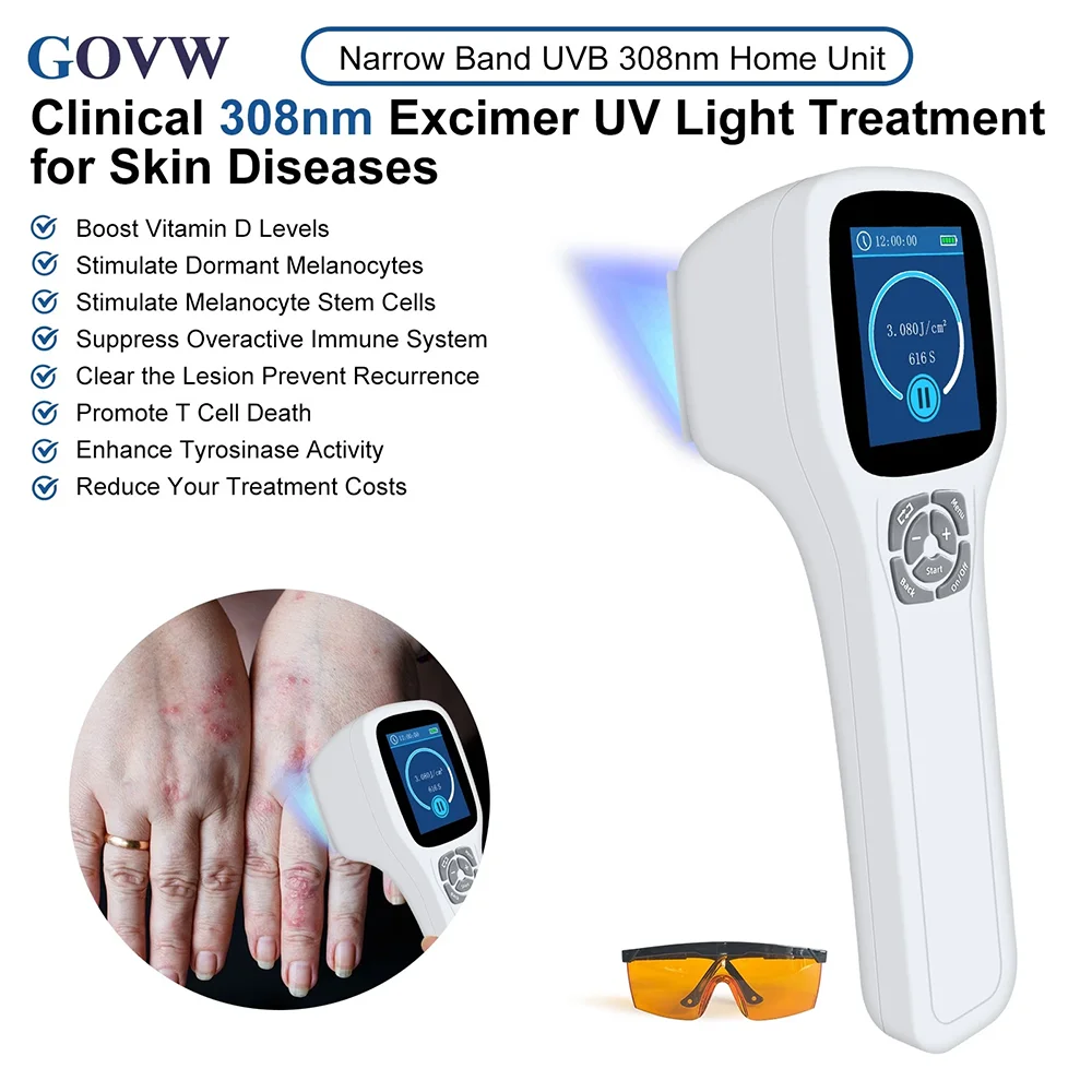 Handheld 308nm UVB Phototherapy Lamp 49 Diodes Targeted Light Therapy Relieve Psoriasis Vitiligo Eczema Dermatitis Skin Disorder