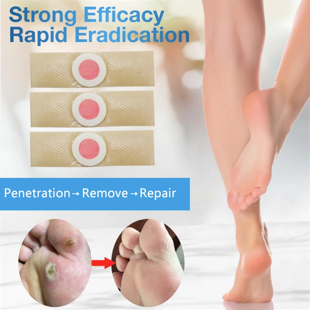 وسادة إزالة الكالس غير المنسوجة ، 42 ، وسادات إزالة الكالس ، عملية ، مفيدة