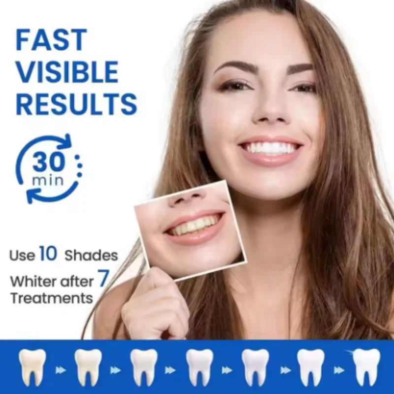 14/28/70 pz mix 3D/5D/9D Gel S - Whitening Strip 3D recensione e prezzo