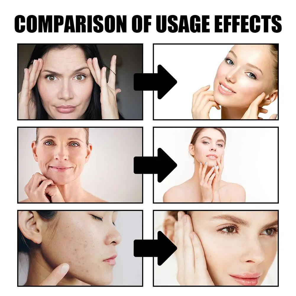 كريم دم التنين إزالة التجاعيد مكافحة الشيخوخة مصل الوجه تتلاشى بقع الخطوط الدقيقة ثبات رفع تبييض تجديد العناية بالبشرة #3