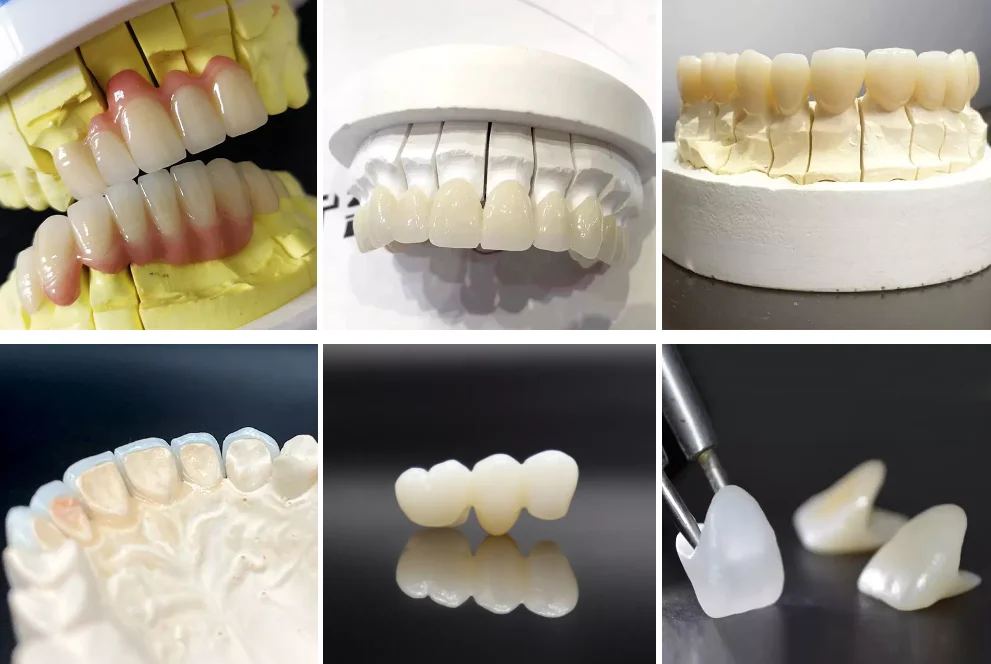 95mm A1 A2 A3 A3.5 A4 Colors 4D Pro Multilayer Zirconia Blocks Zirkonzahn Manual System CADCAM Dental Lab Ceramic Zirconium Disc