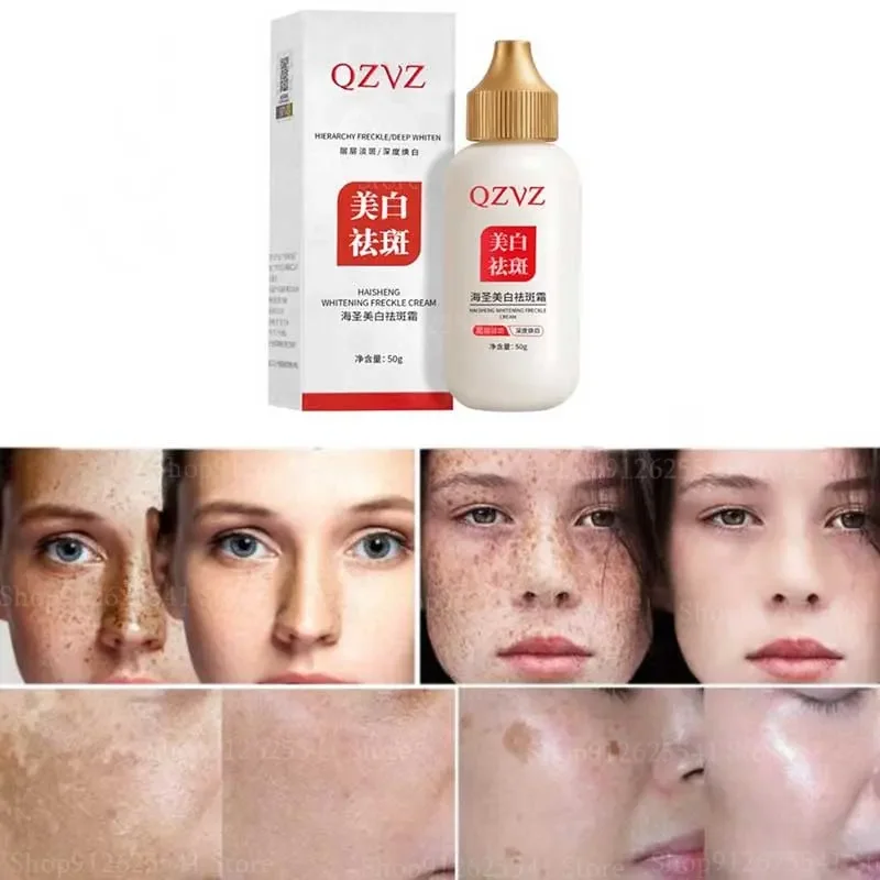 

50g Effective Whitening Freckle Cream Dark Spot Corrector Cream Lighten Pigmentation Improve Dull Skin Remove Melasma Melanin