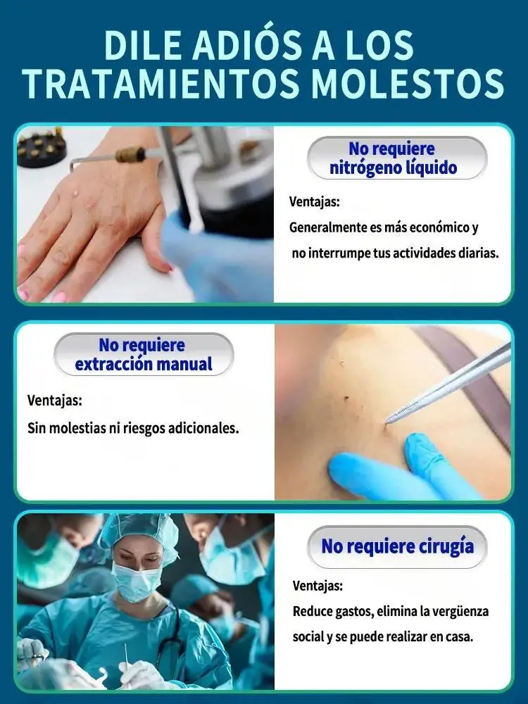 LsWs RWave Off Those Etiquetas de piel sin invitar Removedor de verrugas con luz azul