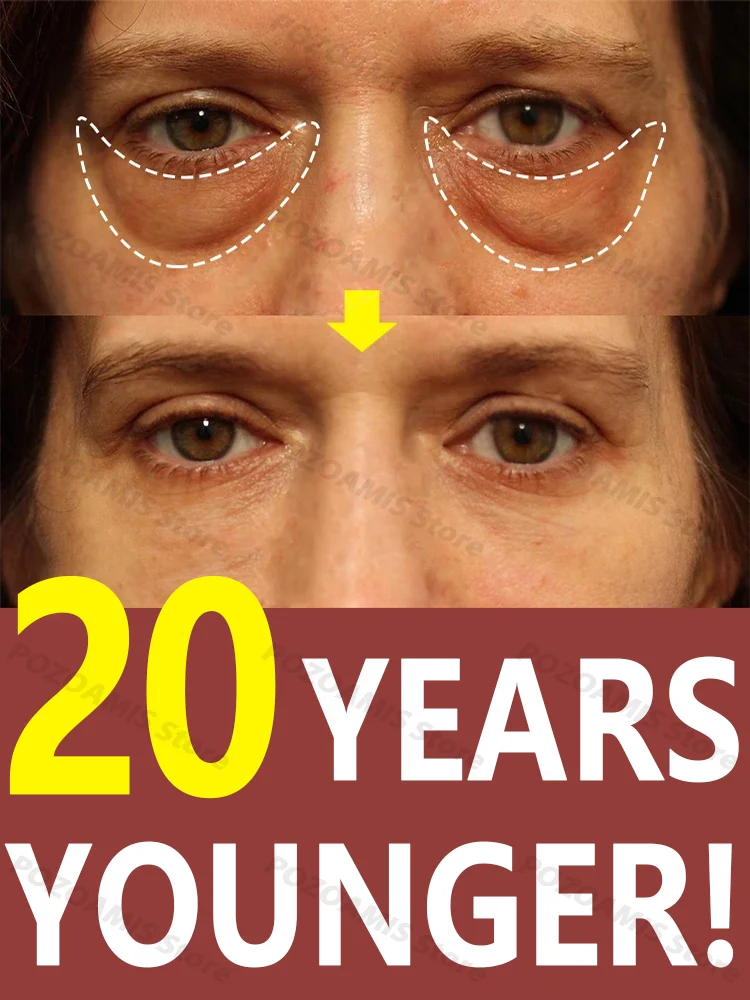 7 days to make you 20 years younger