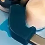 

Set Dental Matrix Bands Clamps Set Sectional Contoured Matrix System Metal Matrices with Nickel Titanium Clamping Rings