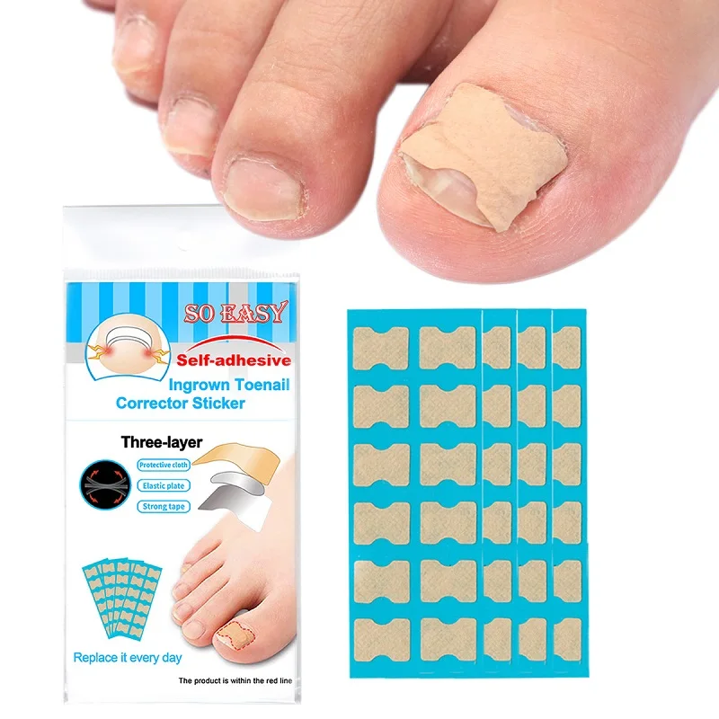 Ingrown Nail Toenail Correction Patch Toenail Corrector Toe Separator Correction Tool Ingrown Toenail Treatment Patch Separators