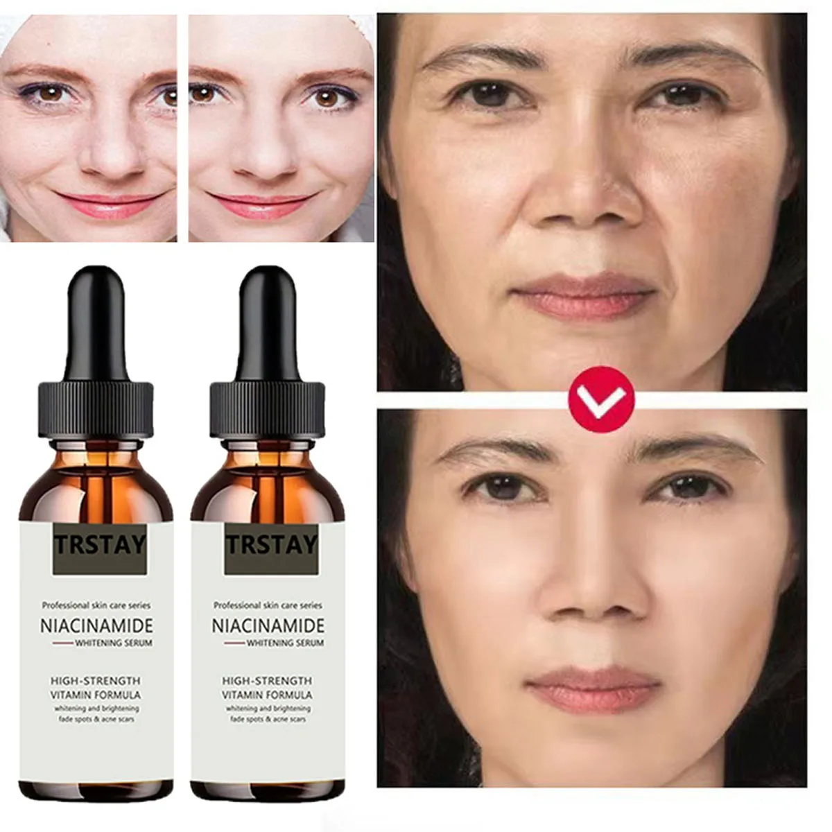 

Effective Whitening Serum Remove Dark Spots Freckle Essence Anti-Aging Niacinamide Fade Pigmentation Melasma Brighten Skin Care