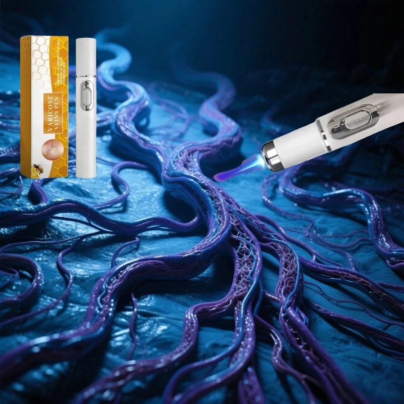 

Eliminate vasculitis, phlebitis, relieve spider leg pain, varicose veins painless treatment
