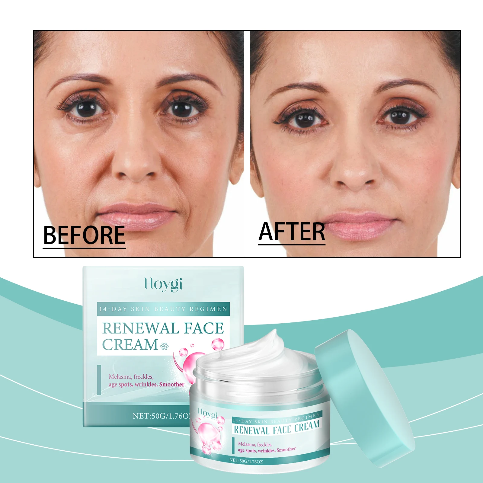 "14-Day Brightening Face Cream for Dark Spots, Wrinkles & Smooth Skin – Anti-Aging for Melasma & Freckles"