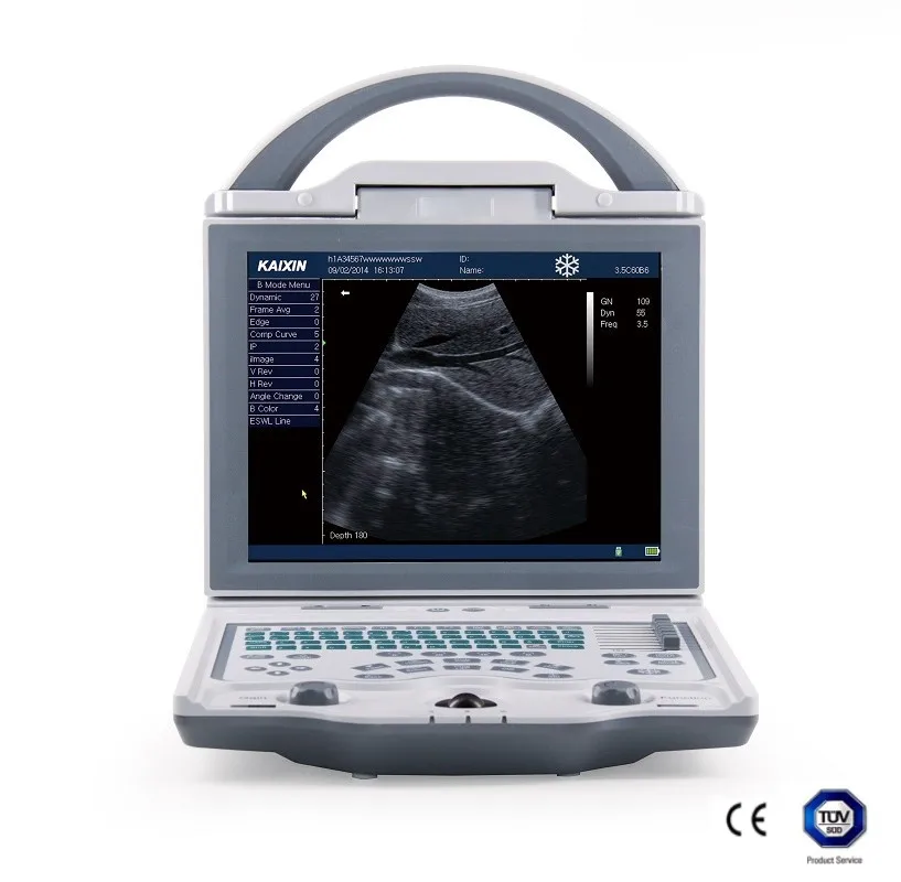 10.4 inch HR LED KX5600 Laptop Black and White Ultrasound Portable USG Machine Human Use