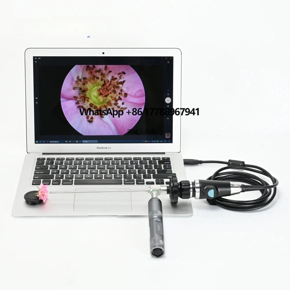 

Medical Portable Full HD 1080P USB Endoscope for ENT