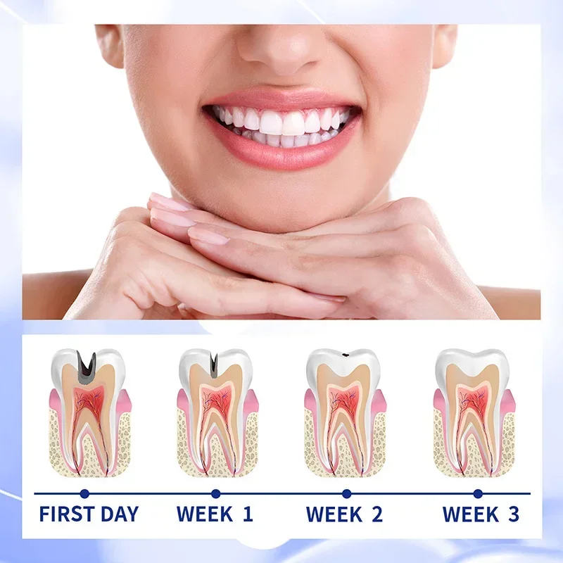 Crema de reparación de Caries dentales, pasta de dientes antidecaimiento, previene la Caries, elimina el cálculo Dental, protege los dientes, refresca la respiración, 30g