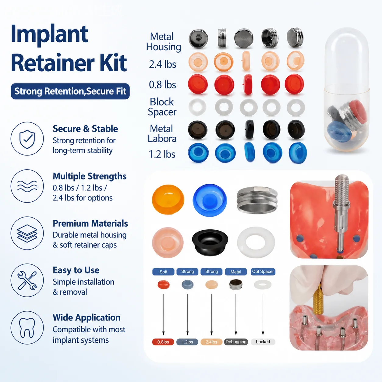 Universal Locator Core Tool & Retention Caps Kit, Implant-Supported Overdenture Abutment Attachment System