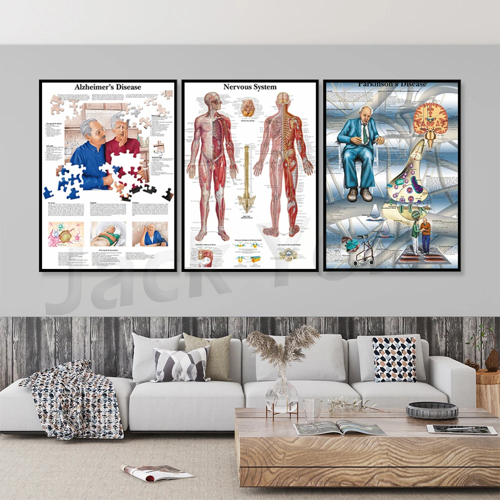 

Human Nervous System Chart Poster Map Canvas Painting Wall Pictures for Medical Education Doctors Office Classroom Home Decor